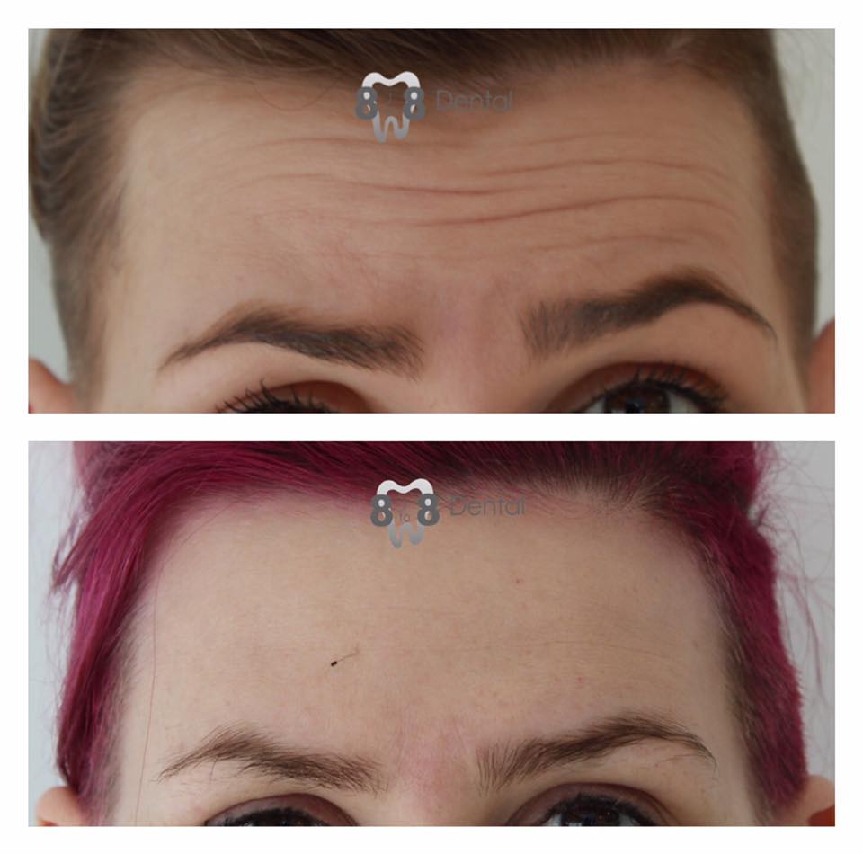 Facial Aesthetics